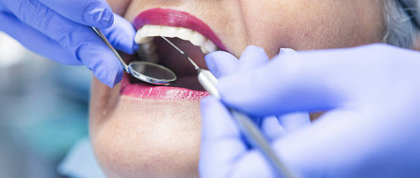 Best Emergency Dental Filling Replacement  in Greenvle, IL